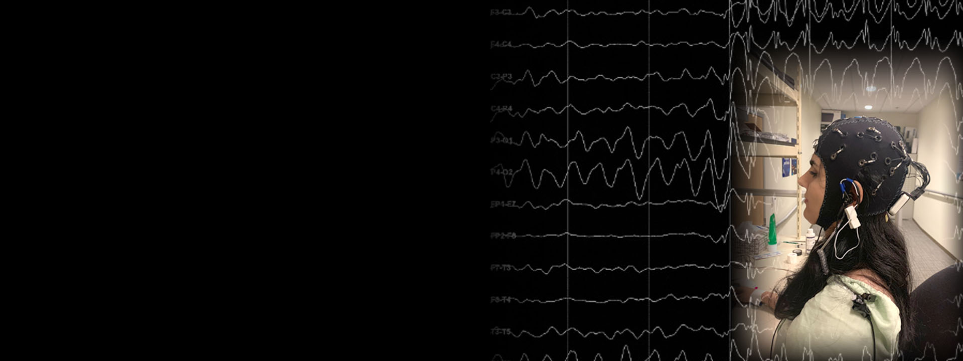 Wizualizacja aktywności neuronalnej w czasie rzeczywistym mapa aktywności neuronów w mózgu z naniesionymi elektrodami